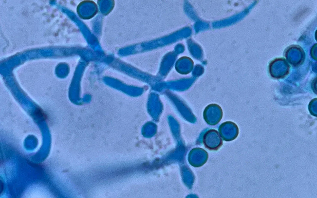 Rhizobacteria and Trichoderma